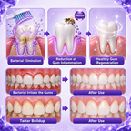 Ceoerty® Gingivitis Periodontal Treatment Toothpaste
